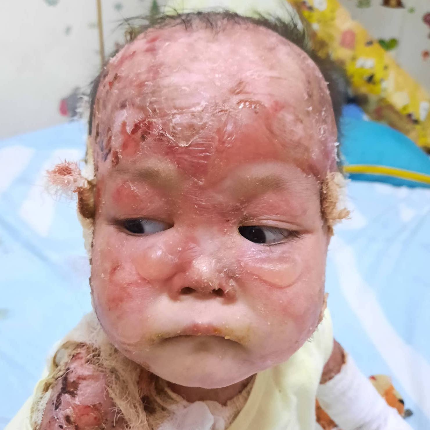 Child receiving medical care